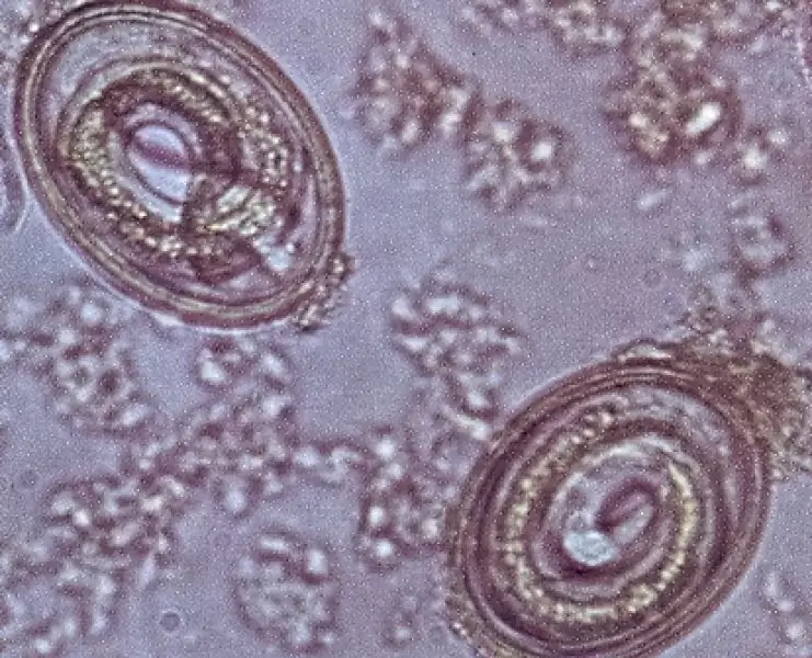 roundworm eggs